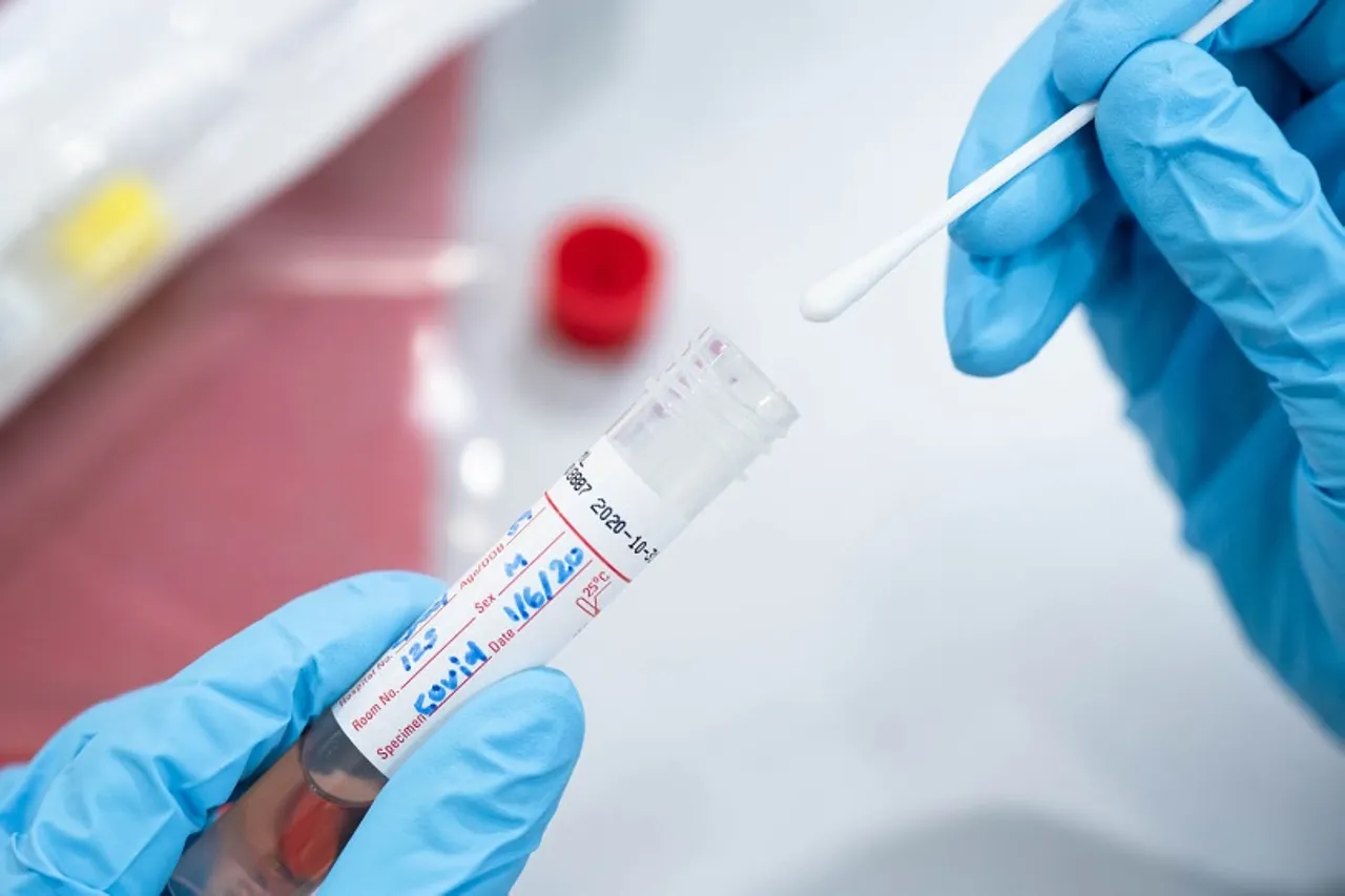 Assam Logs 844 New Cases of COVID-19
