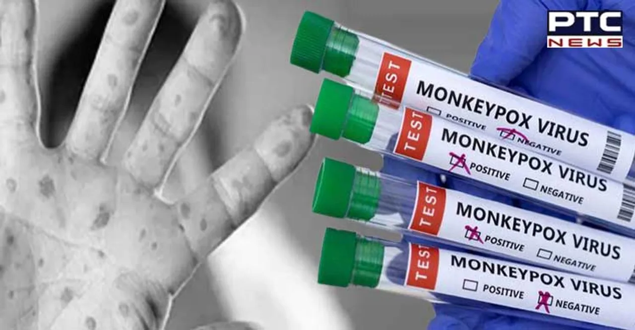 Antiviral tecovirimat effective in treatment of monkeypox symptoms: Study