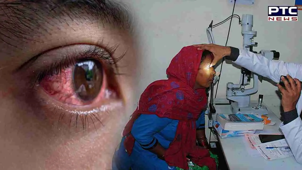 EYE INFECTION CASES: ਬਠਿੰਡਾ ਜ਼ਿਲ੍ਹੇ ਵਿੱਚ ਤੇਜੀ ਨਾਲ ਵੱਧ ਰਹੇ ਆਈ ਫ਼ਲੂ ਦੇ ਮਾਮਲੇ