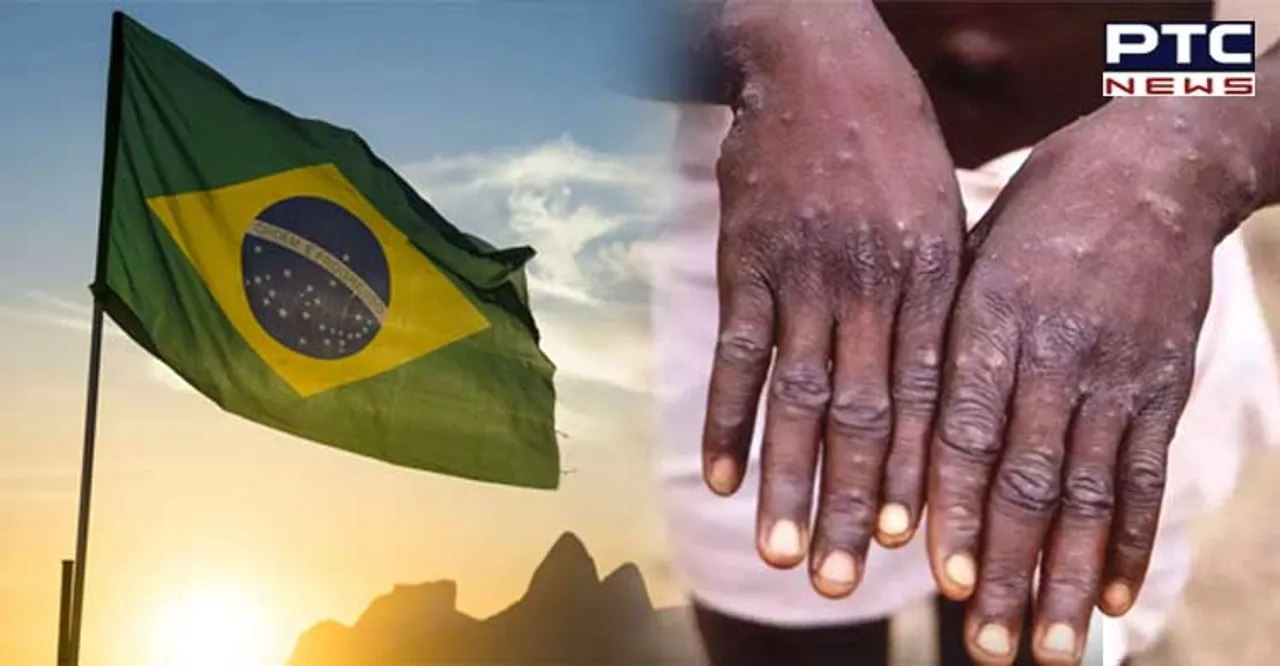 Brazil confirms first monkeypox case; patient's contacts being monitored