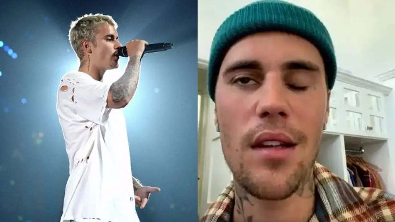 Justin Bieber opens up about his facial paralysis; says, 'Eye isn't blinking, can't smile' [Watch Video]