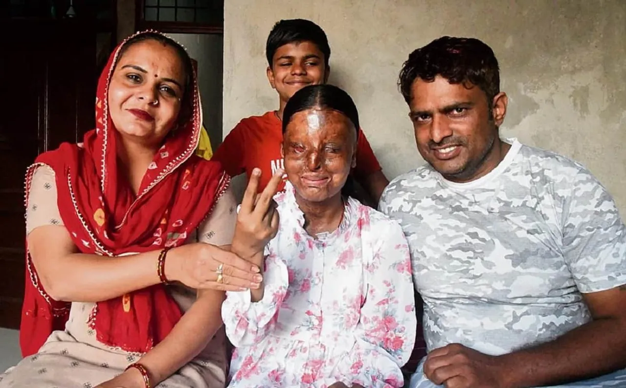 acid attack survivor kafi tops 10 board