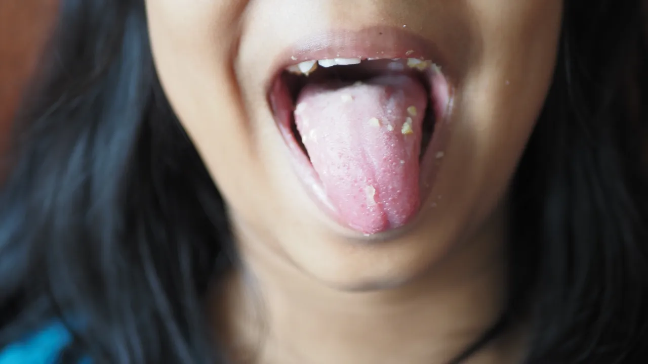 Tongue 