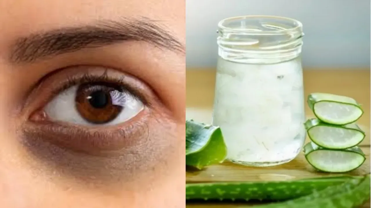 Dark Circles: రాత్రి పడుకునే ముందు ఇది రాస్తే కళ్ల కింద డార్క్‌ సర్కిల్స్‌ మాయం