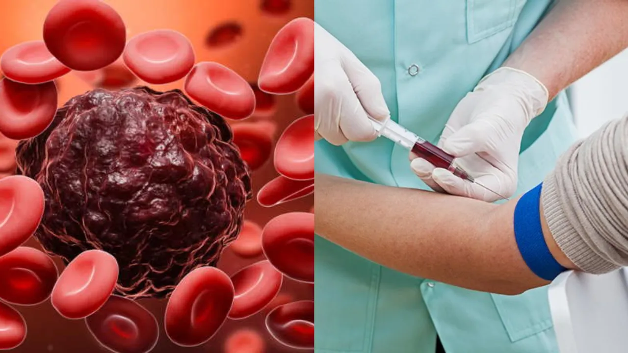 Blood Cancer: 7 సంవత్సరాల ముందుగానే బ్లడ్‌ క్యాన్సర్‌ను గుర్తించవచ్చా?