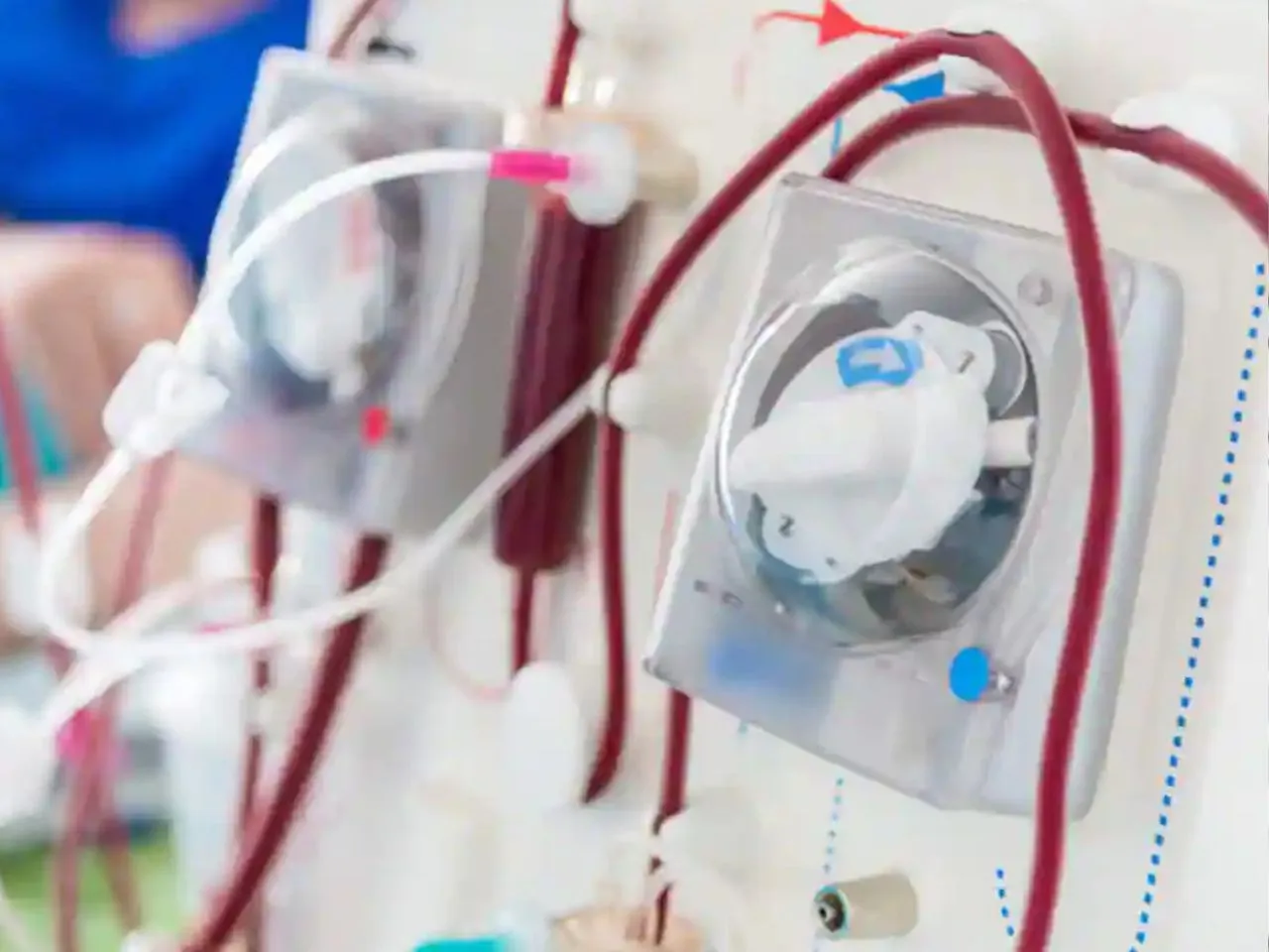 dialysis