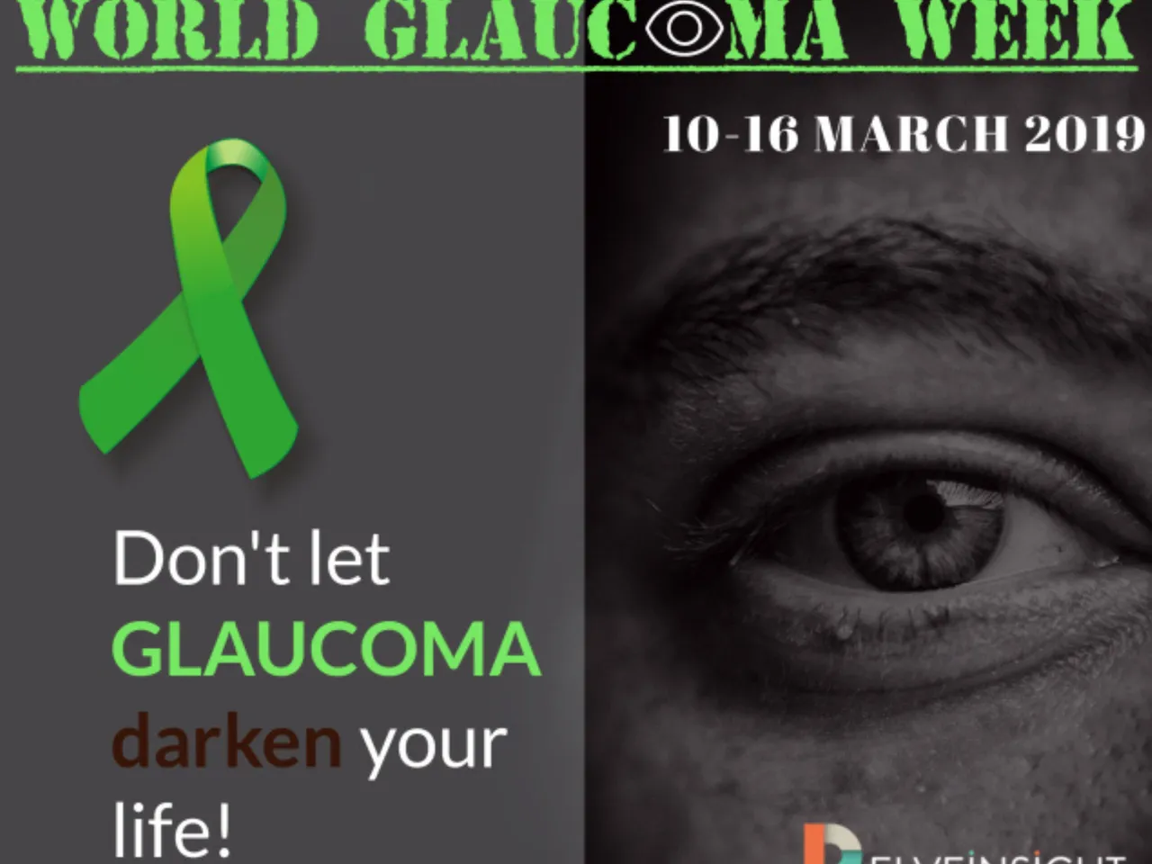 glaucoma