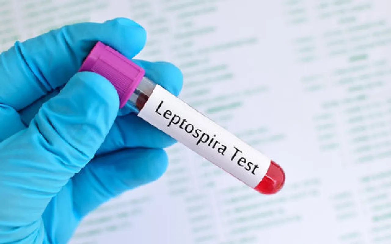 leptospirosis1