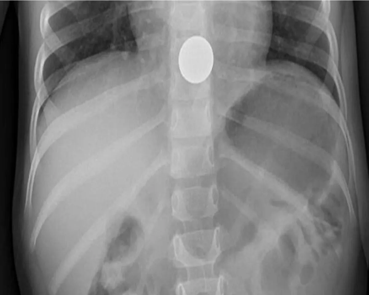 child locket