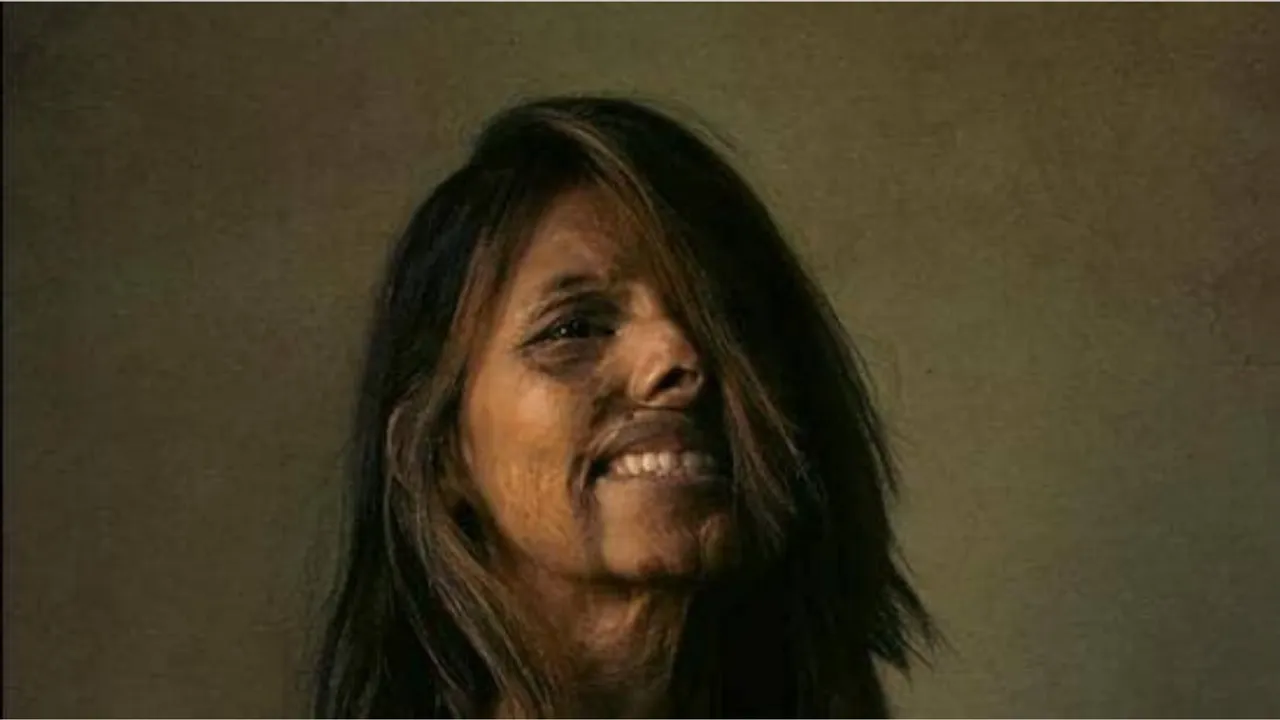 Who Is Anmol Rodriguez? Acid Attack Survivor In Award-Winning Photo Series