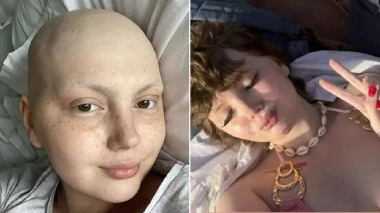 What Is Ewing Sarcoma? TikTok Creator Leah Smith Dies Battling Rare Cancer