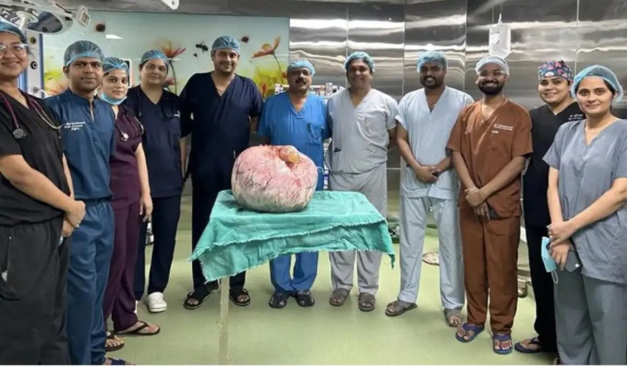 Indore Doctors Remove 15 Kg Tumour From Woman's Abdomen