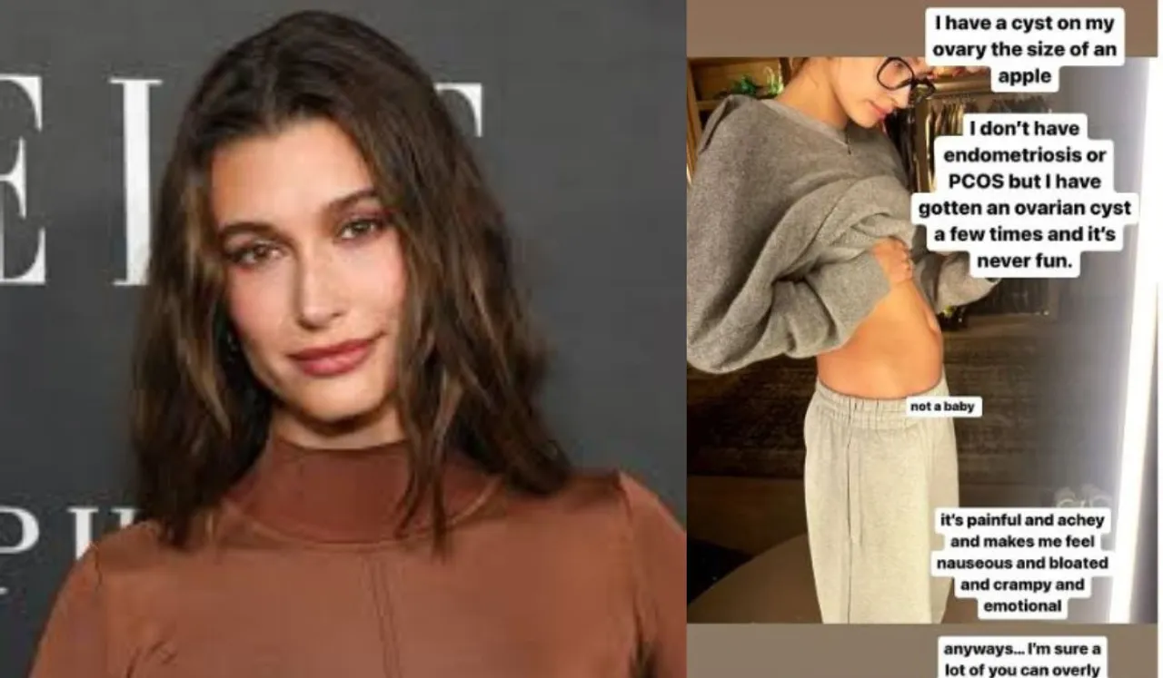 What Is Ovarian Cysts? Hailey Bieber Opens Up About The Health Condition
