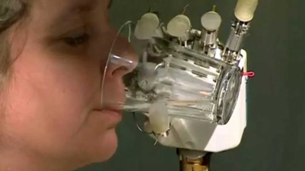 London Woman Feels Sense Of Touch Through Bionic Hand