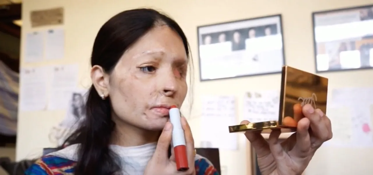 Exclusive - A face is not everything: Acid attack survivor Reshma Qureshi