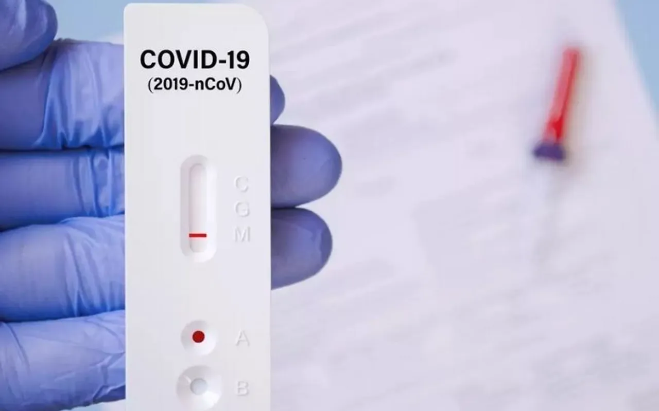 10 Things To Know About RAT Kit For COVID-19 Self Testing