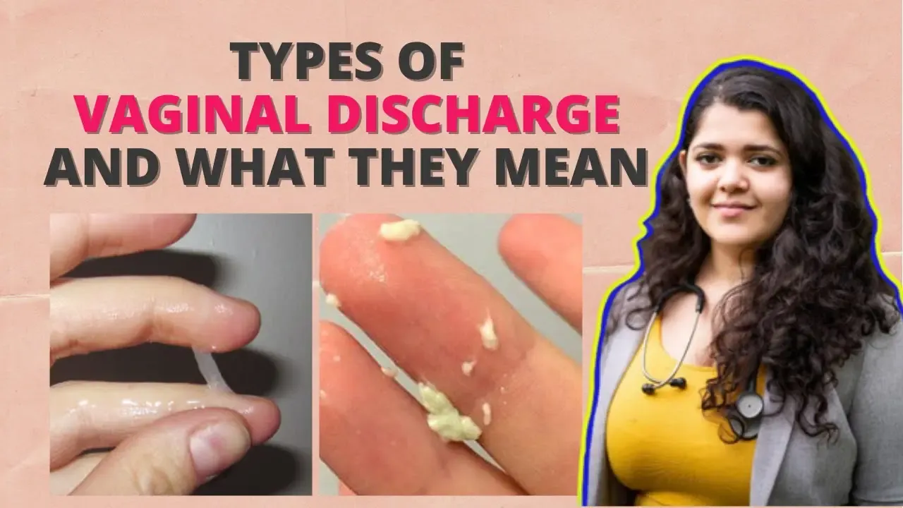 Types Of Vaginal Discharge 7228
