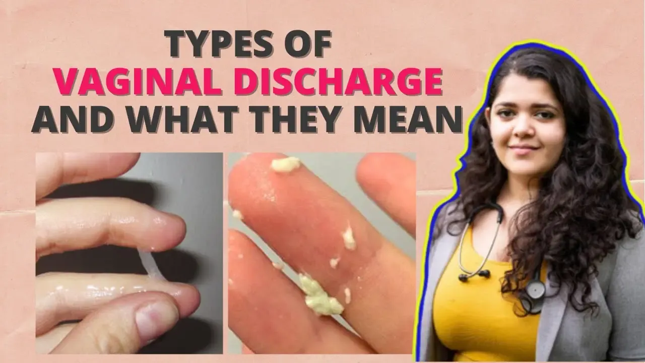 Types Of Vaginal Discharge Every Girl Should Know About 1195