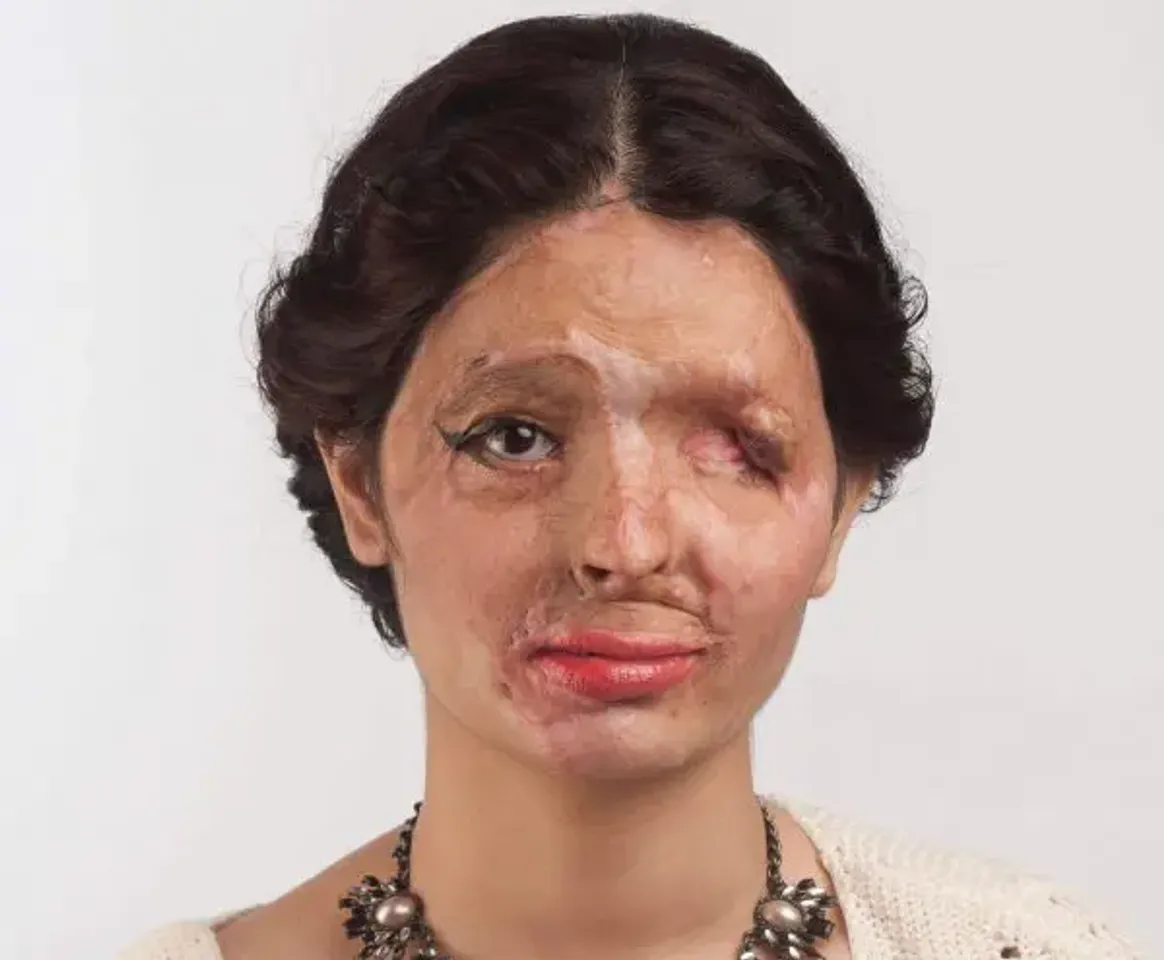 Reshma Qureshi Tania Singh, Acid Attack Cases