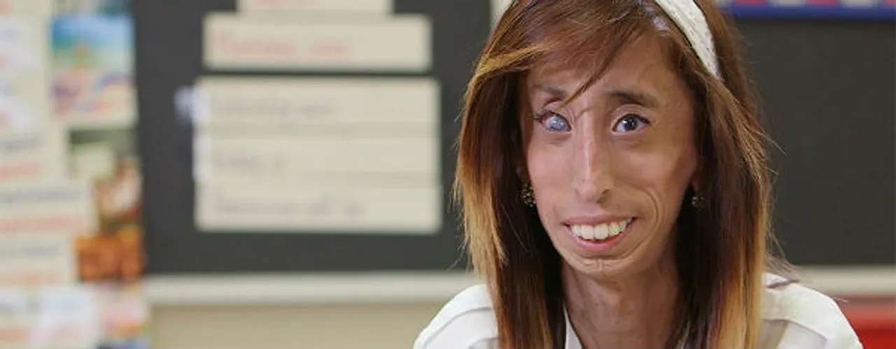 Lizzie Velasquez Shares Moving Message About Online Bullying