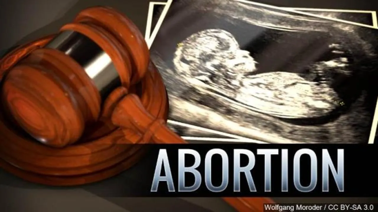 US Supreme Court To limit Abortion Rights?
