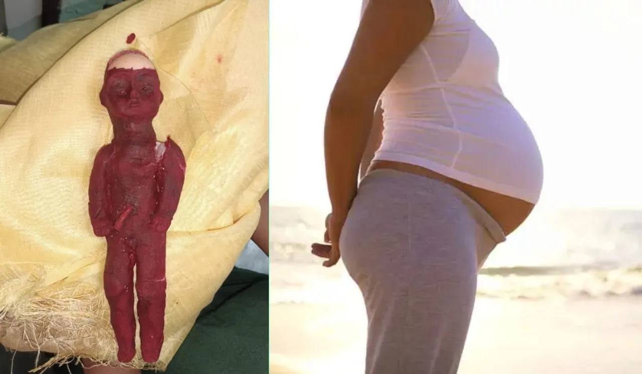 Woman Fakes Pregnancy Using Plastic Doll