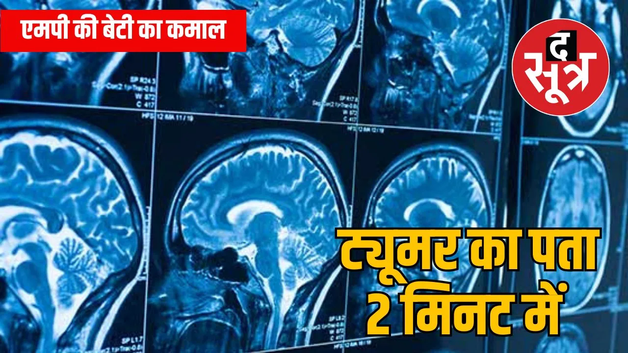 ब्रेन ट्यूमर के लिए एआई बेस्ट ऐप