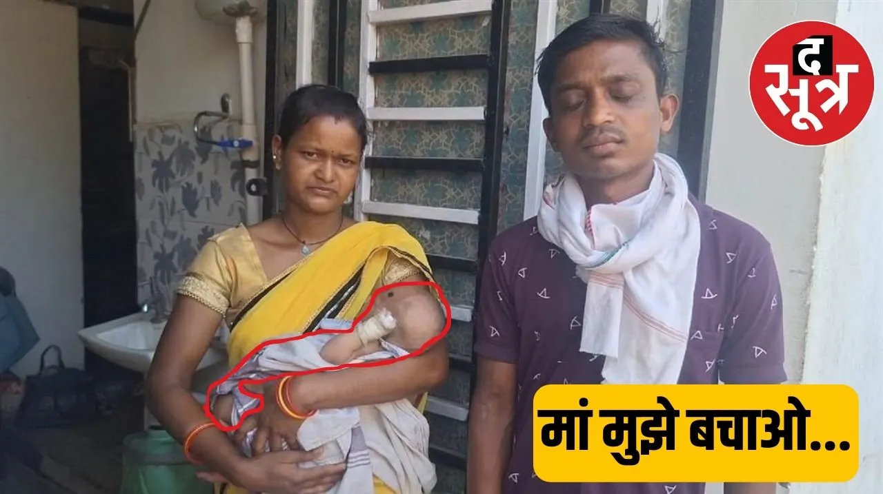 छत्तीसगढ़ के जशपुर में 18 दिन की बच्ची का पेट फूला तो बैगा ने दाग दिया गर्म सरिया
