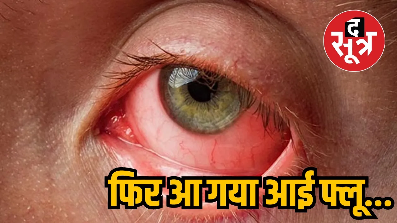 Eye flu is spreading again in Chhattisgarh