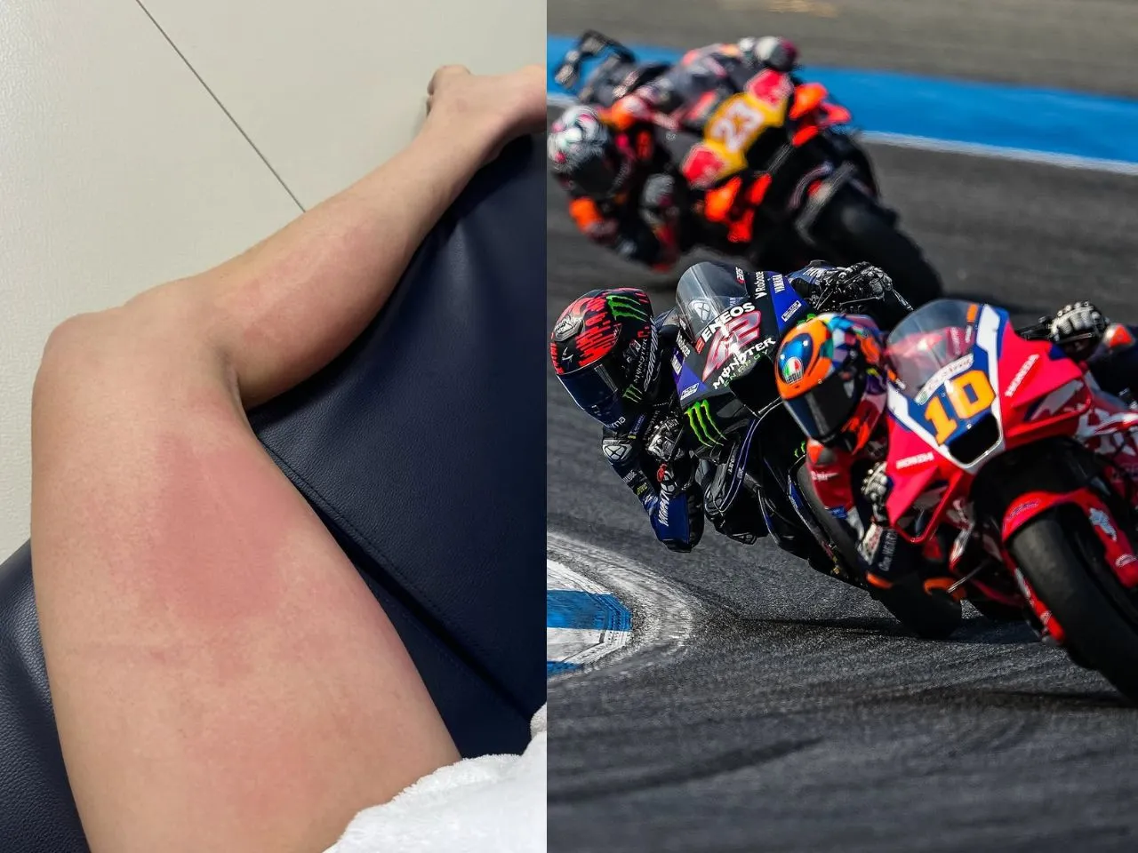 Joan Mir and Alex Rins suffered Burns during the 2025 Thailand Grand Prix