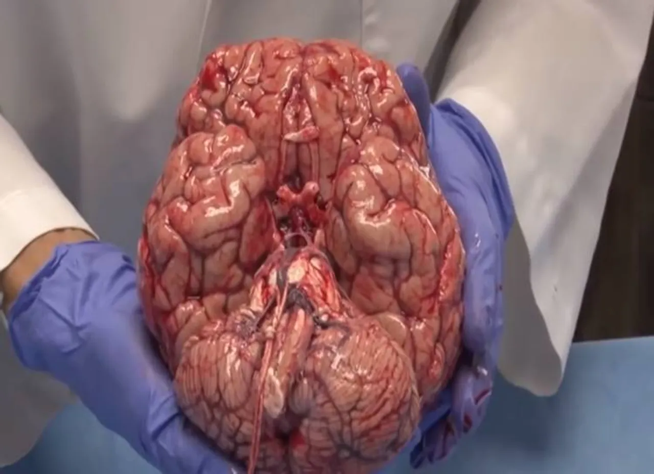 human brain, brain parts, brain mechanism
