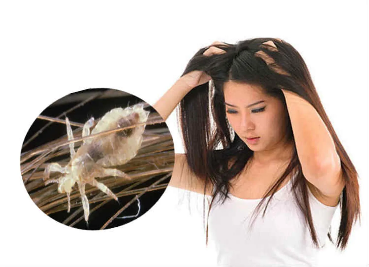 lice problems, பேன் தொல்லை