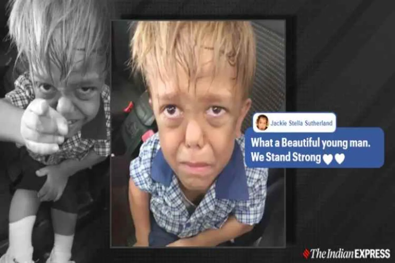 nine-year-old bullied, video of nine year old crying after getting bullied, hugh jackman, dwarfism, video of bullied boy, bullying in school, viral video, trending, indian express news