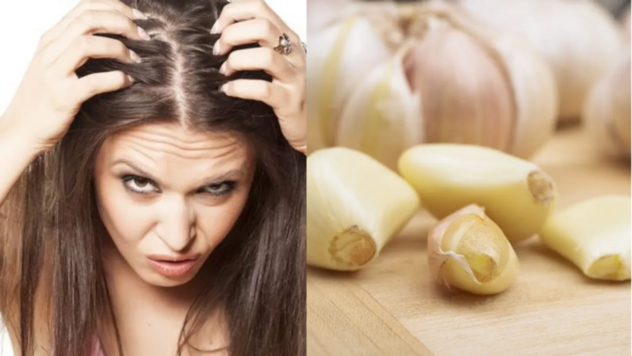 Benefits of Garlic for Dandruff problem Tamil News