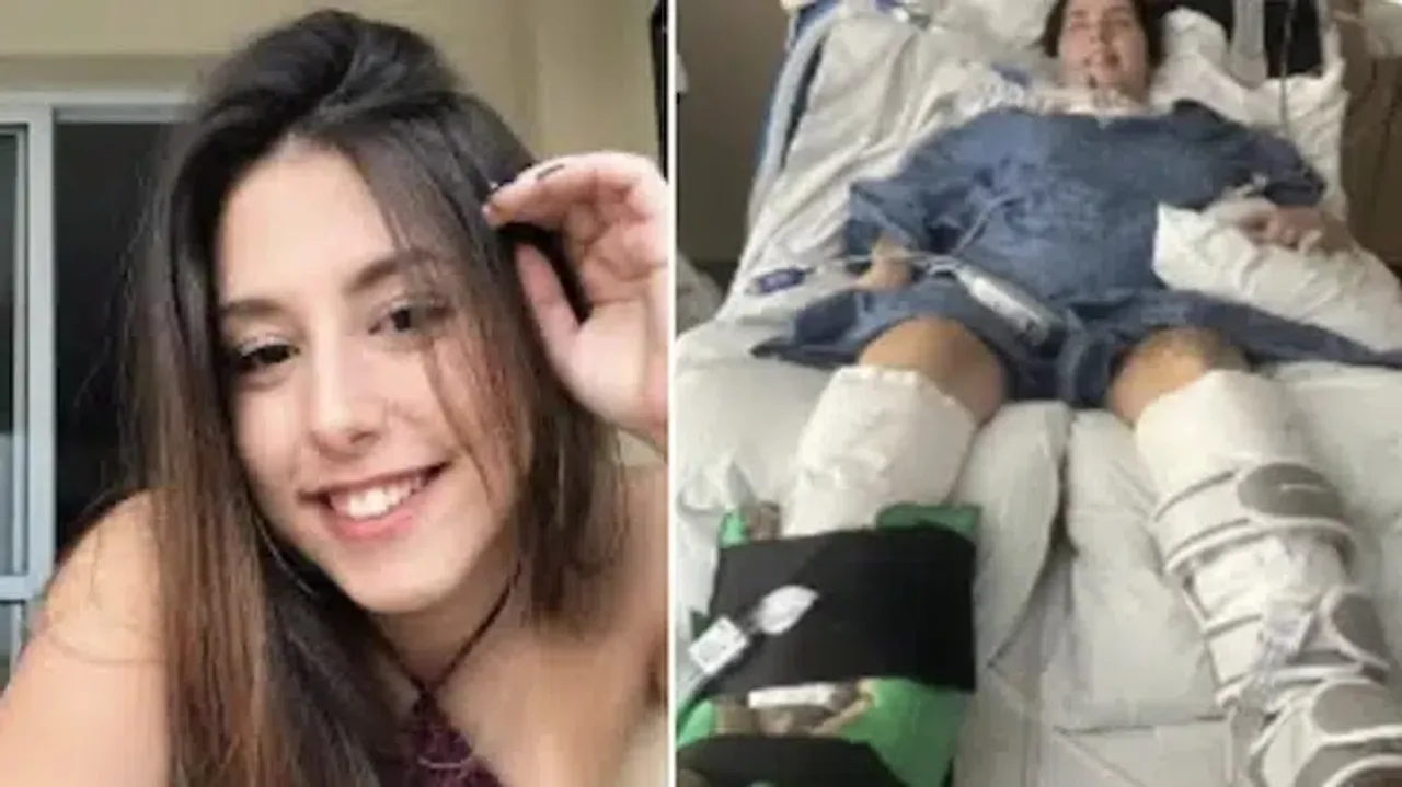23-Year-Old Brazilian Woman Paralyzed After Eating Contaminated Canned Soup in Colorado