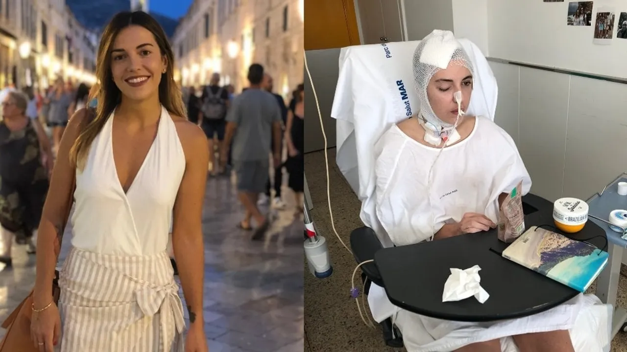 Brazilian Woman Suffers Traumatic Brain Injury After Being Hit by Police Car in Barcelona