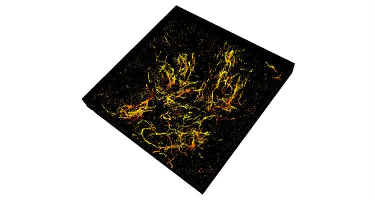 Purdue researchers have taken D single molecule super resolution images of the amyloid plaques associated with Alzheimers disease in micron thick sections of the mouses frontal cortex