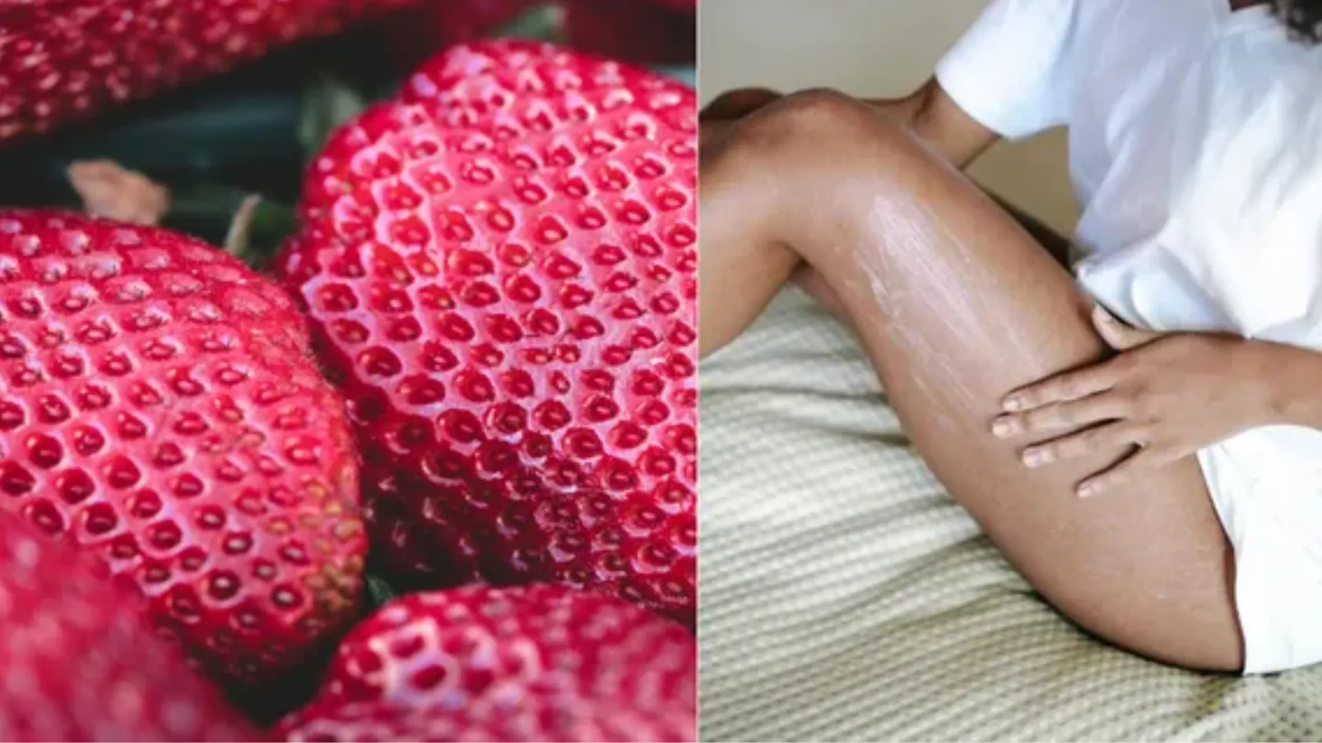 Strawberry Skin