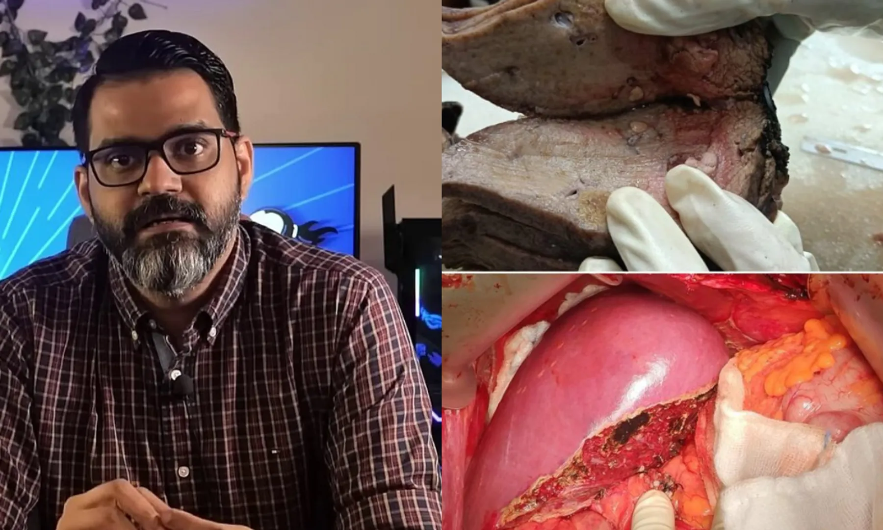 liver doc