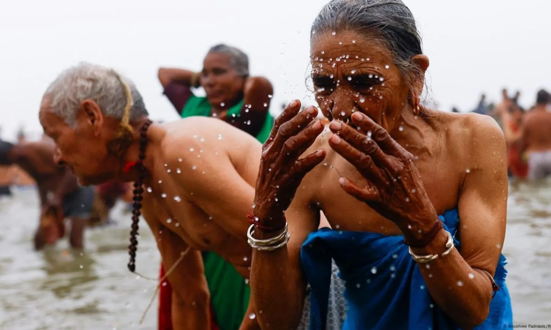 Ranchi doctors report surge in skin infections among Kumbh returnees