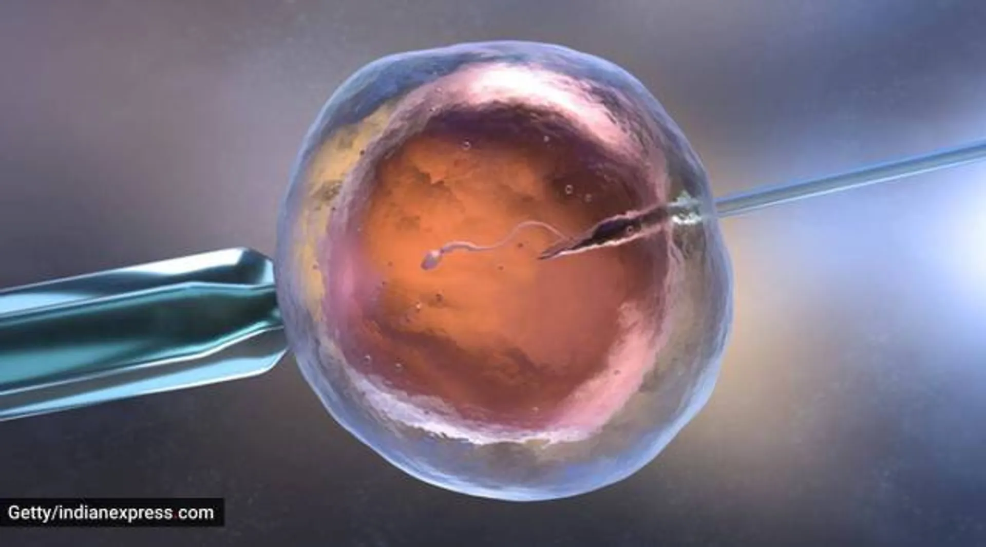 New Delhi: NCDRC imposes Rs 1.5 crore fine on private hospital for mix-up in semen samples during IVF procedure 