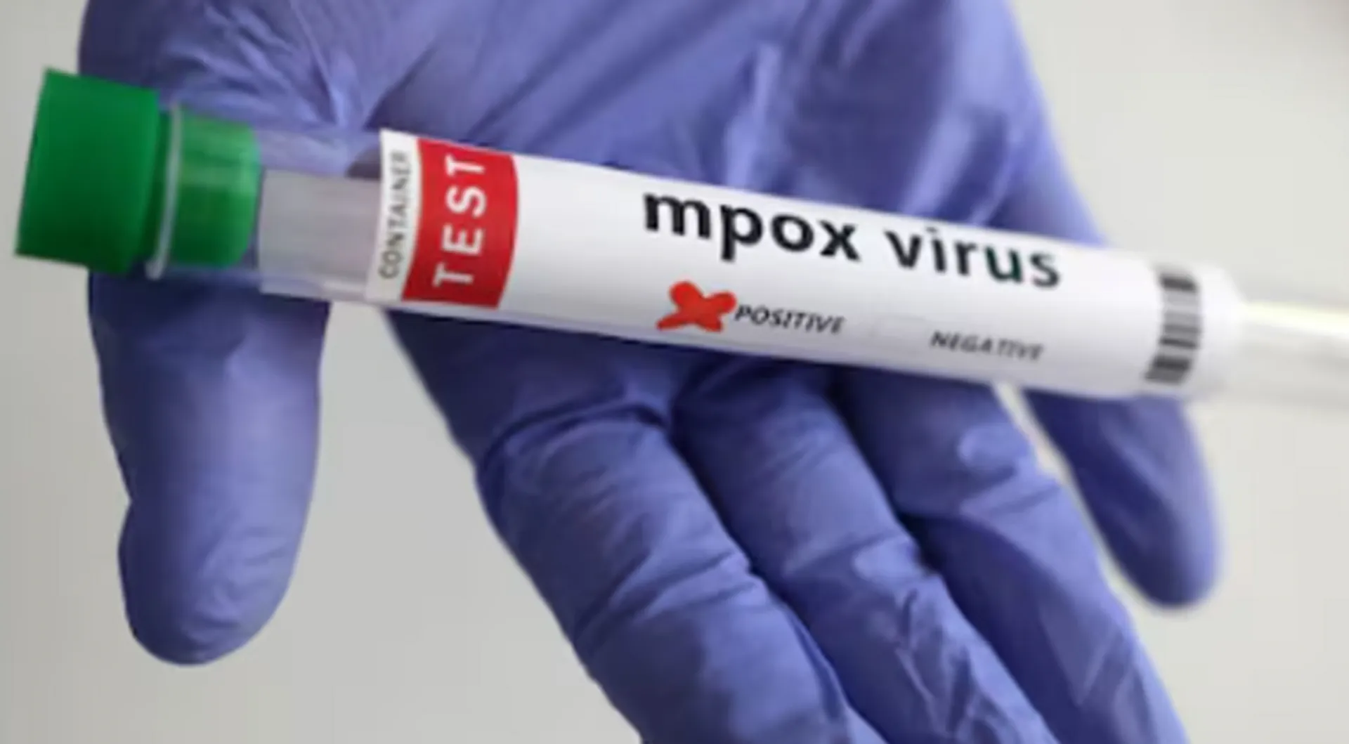 New Mpox Strain