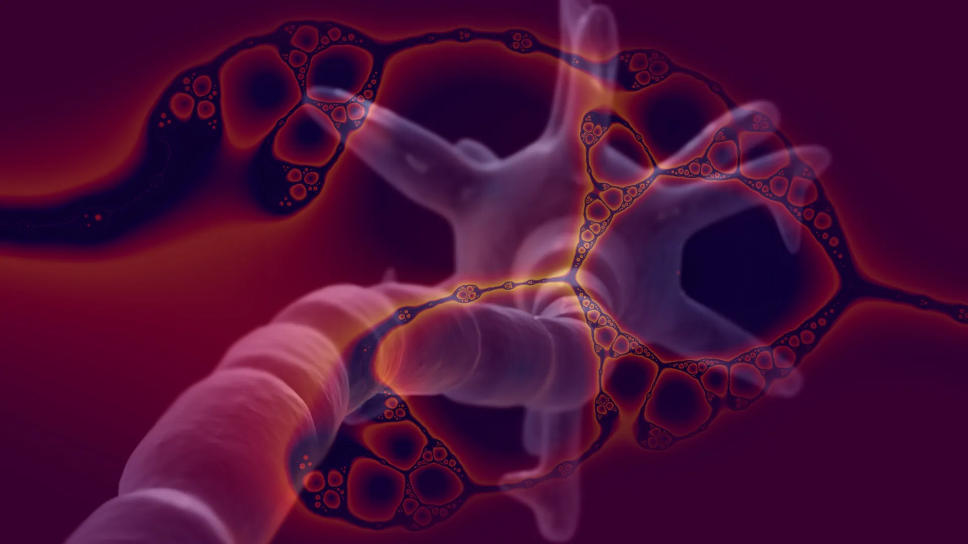 What is Guillain-Barré Syndrome, rare disorder 59 people diagnosed with in Pune? 