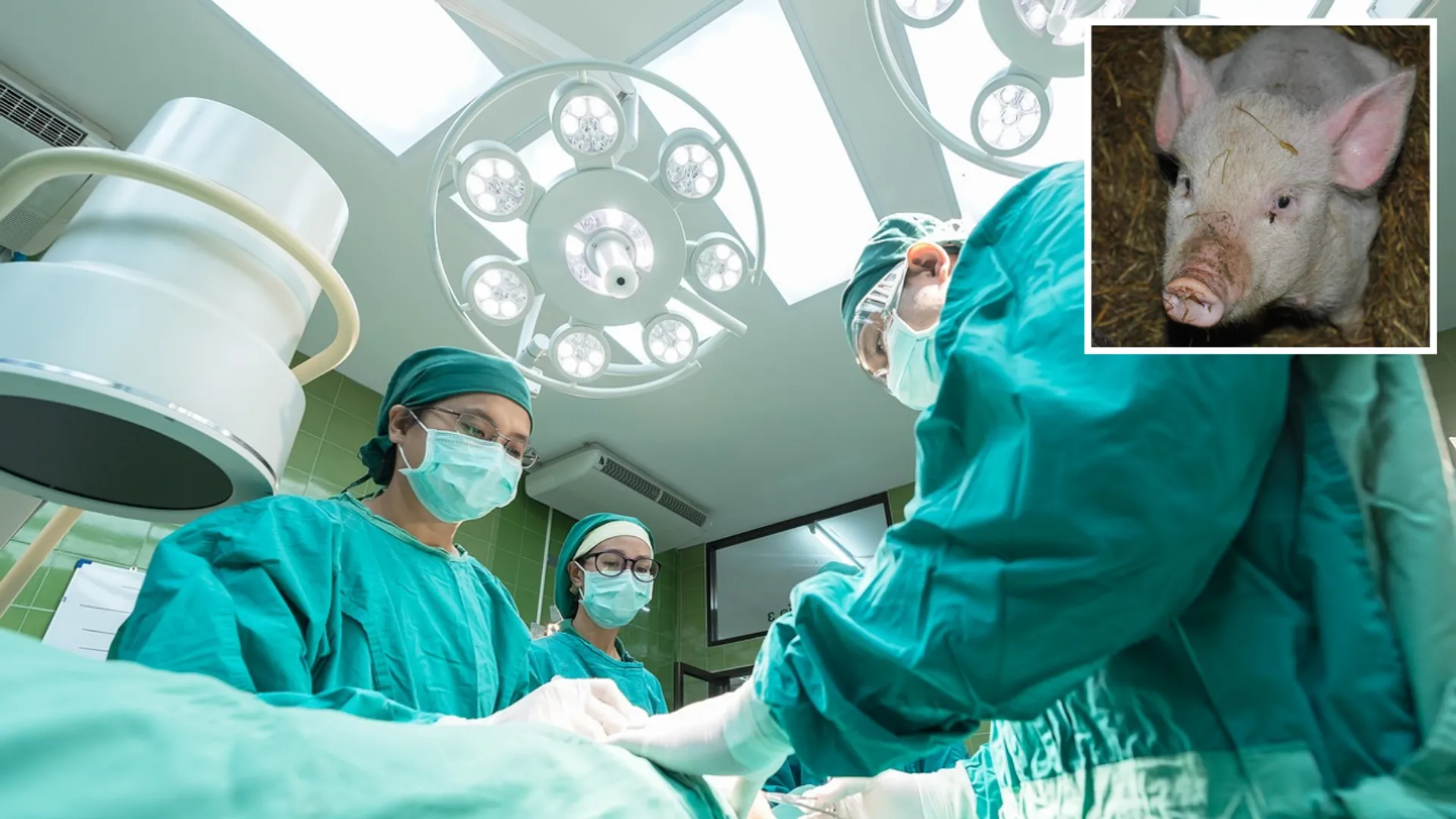 liver transplant