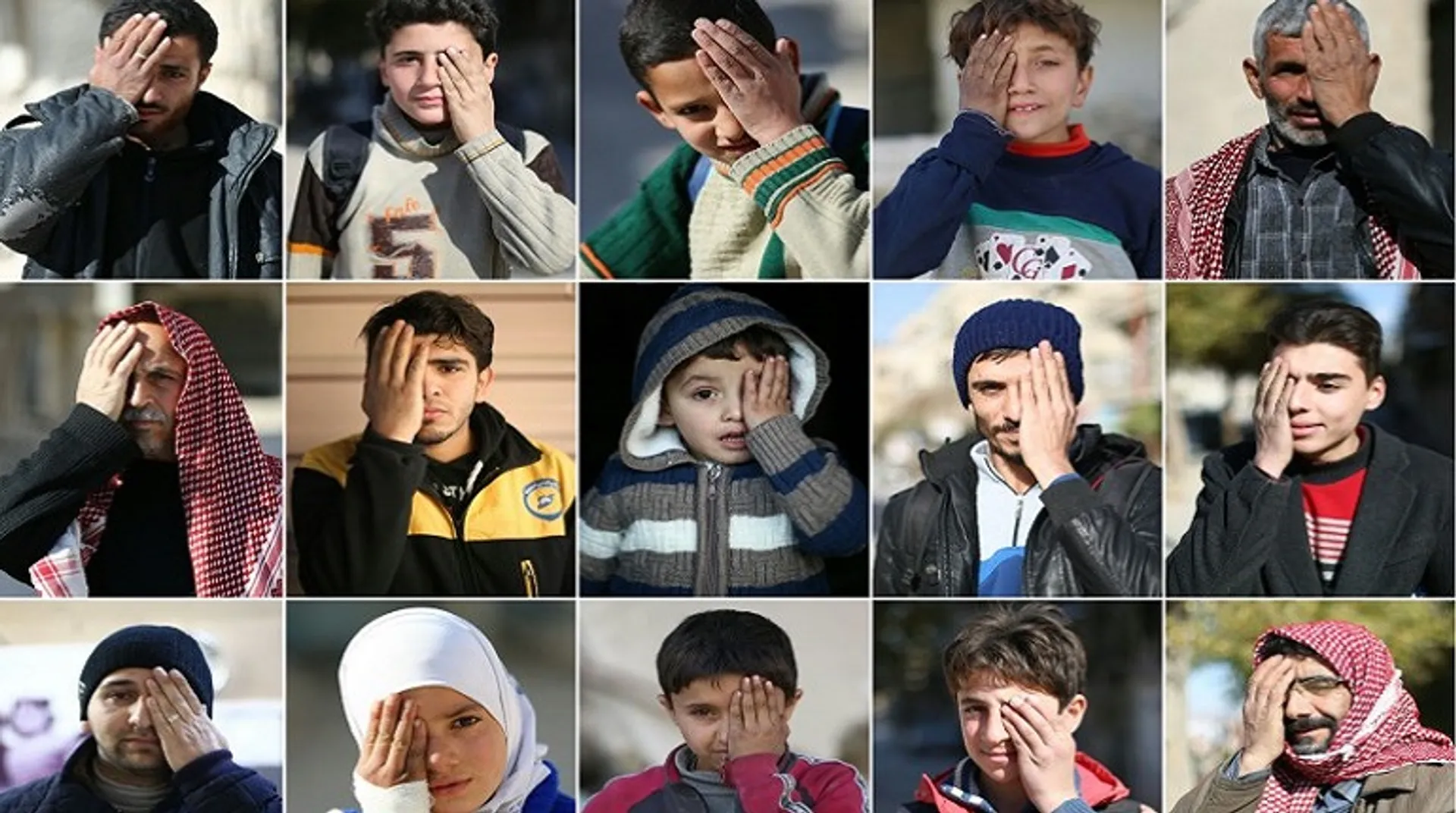 Blinded in one eye, Syrian baby becomes symbol of siege