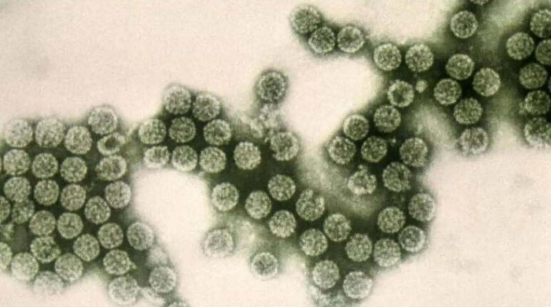 Study reveals new molecule that inhibits drug-resistant bacteria