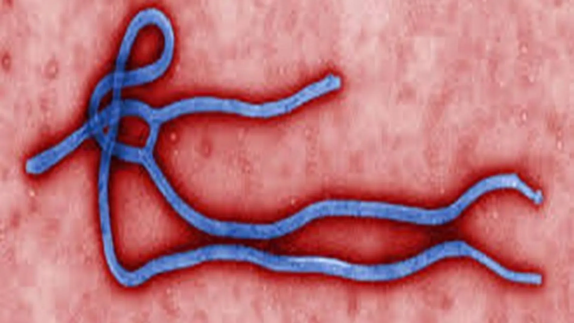 Ebola outbreak declared in Uganda by WHO