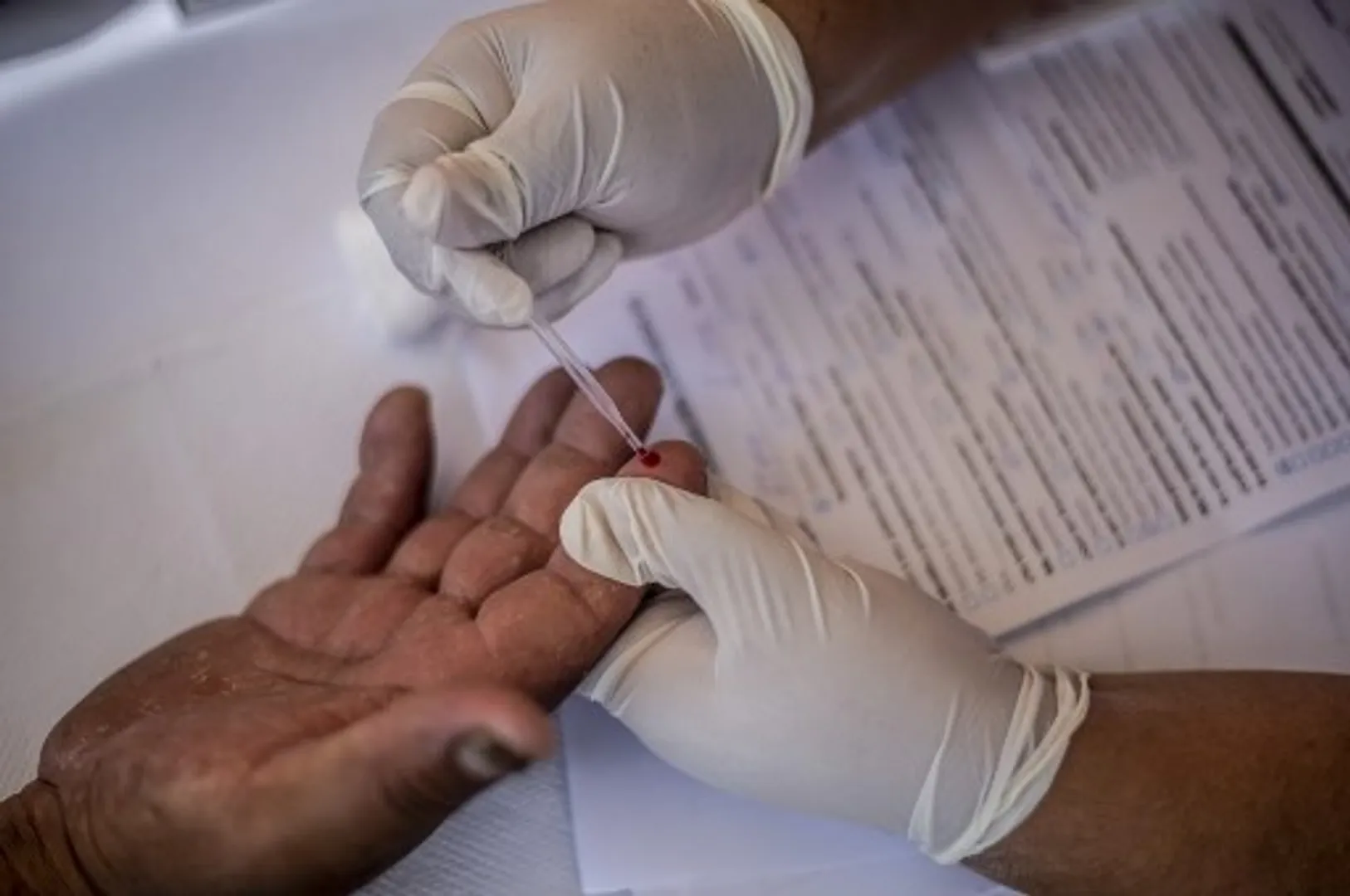Another patient cured of HIV after undergoing stem cell transplant, claim doctors