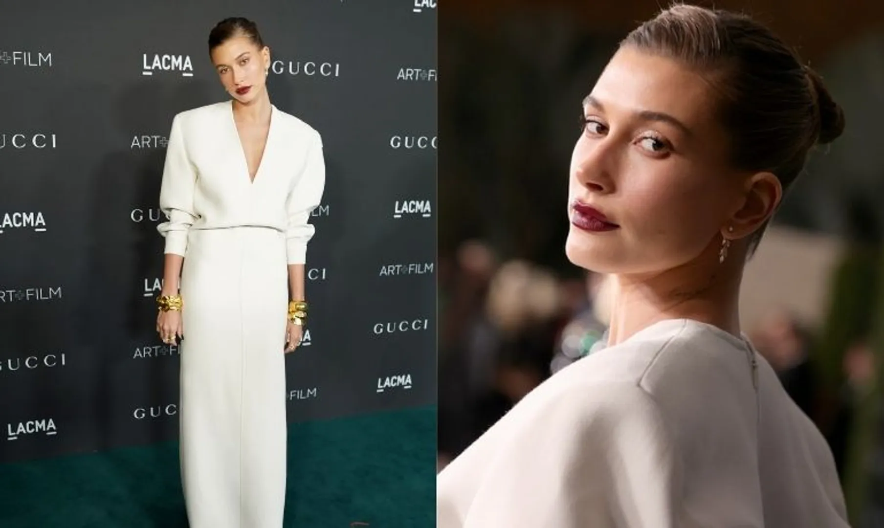 Hailey Bieber reveals she had PTSD post suffering mini-stroke last year