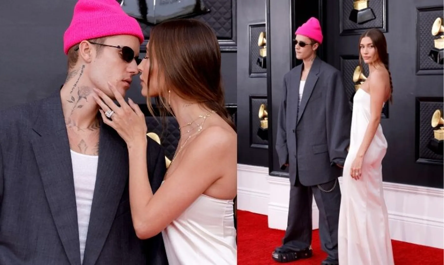 Hailey Bieber says Justin Bieber is doing ok after his partial facial paralysis